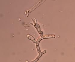 A microscopy picture of a clear fungal hypha with a bulbous structure with 4 spikes.