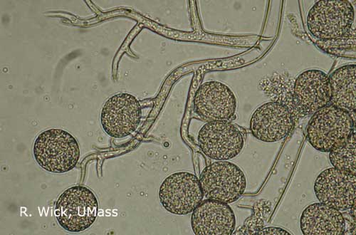 Downy mildew on coleus under the microscope