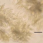 Pigmented, curved, fusiform conidia with one to several transverse septa produced by Lecanosticta acicola (scale bar = 40 µm). Photo by N. Brazee