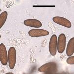 Eliptic, dark brown conidia produced by Diplodia sapinea (Scale bar = 40 µm)
