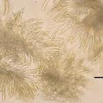 Conidia of Lecanosticta acicola (brown needle spot). Scale bar = 40 µm.