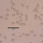 Asexual spores (conidia) produced by the foliar pathogen Tubakia.