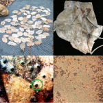 Figure 4) Top left: scab infected leaves lie on the ground overwinter. Top right: overwintered apple leaves with scab lesions still visible. Bottom left: close up of overwintered scab infected apple leaves showing fruiting bodies that contain the spore that cause primary infections in the spring. Bottom right: ascospores ejected from fruiting bodies. When these land on leaves in the spring, they cause lesions that produce new spore, leading to additional infections. 