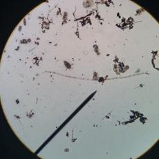 Organisms up close under the lens of a microscope