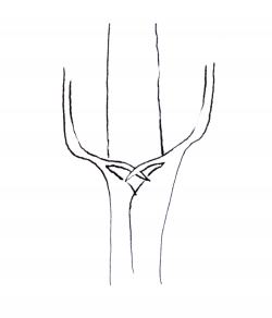 Auricles are finger-like protrusions that wrap around the stem from the blade at the collar region.